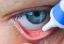 Experimental eye drops help blind mice see again