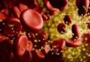 One CRISPR treatment cut “bad” cholesterol in half for a full year