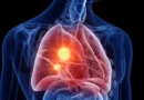 New mesothelioma drug turns cancer’s own defenses against it