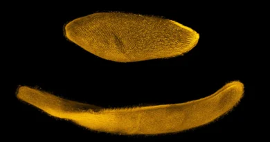 This tiny organism can shrink to one quarter its size in milliseconds