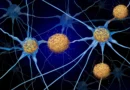 Alzheimer’s may leave a mark on the brain long before plaques appear